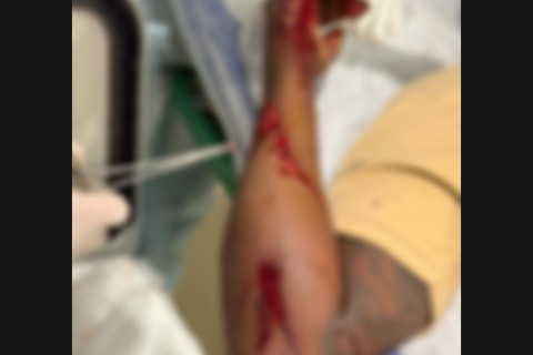 Briga entre funcionários termina com homem ferido a golpes de faca em Porangatu